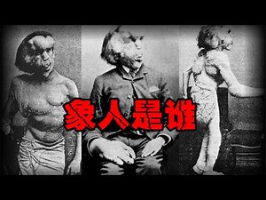 [Legend of Elephant Man] Deformed people who have been deprived of their lives!