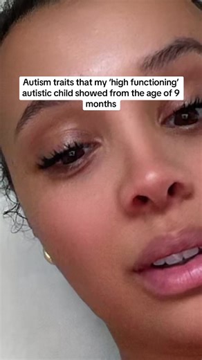 Autism Traits in My High Functioning Child