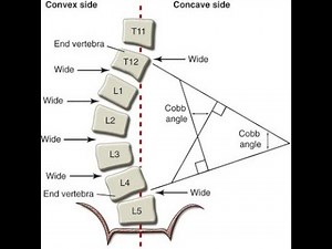 COBB'S ANGLE #shorts #shortvideo