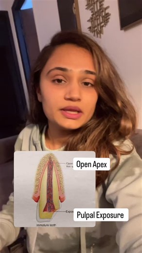 Dr Rukmi on Instagram: "Pulpotomy Back to Basics [dental education] [aesthetics] [root canal treatment] [botox] [viral] [trending hashtags]"