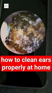 how to clean ears properly at home #shorts