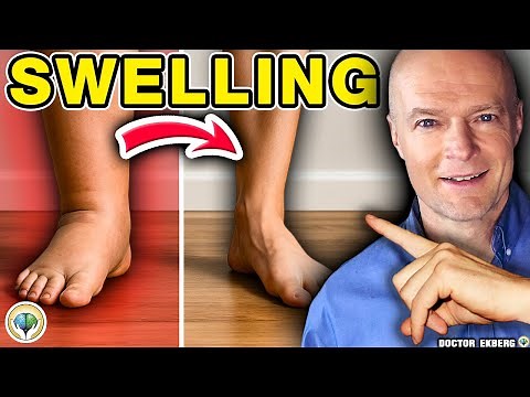 #1 Absolute Best Way To REDUCE SWELLING In Your Legs And Ankles