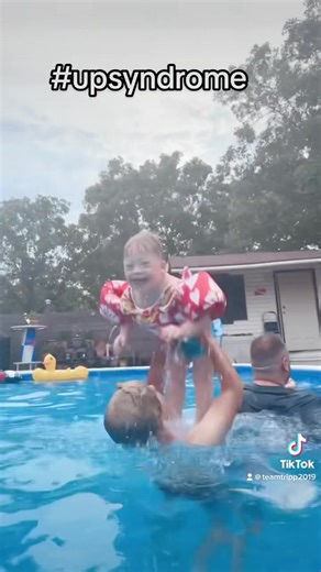14K views · 1.1K reactions | Tripp is a swimming machine  #upsyndrome | TeamTripp | Facebook