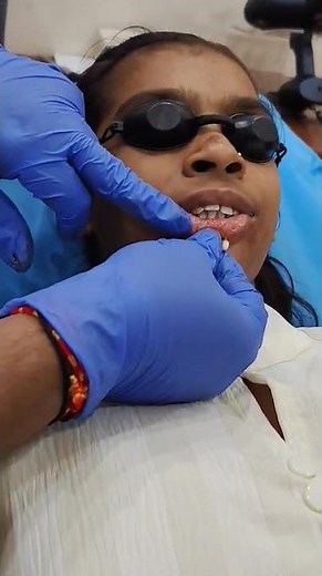 Mole on Lips Surgery – Safe, Scar-Free & Expert Care