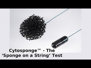 Cytosponge™ - The ‘Sponge on a String’ Test