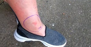 Raleigh woman bit by copperhead snake while protecting dogs