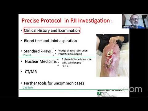 Update on Periprosthetic Joint Infection