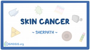 Skin cancer: Nursing pathophysiology: Video, Causes, & Meaning | Osmosis