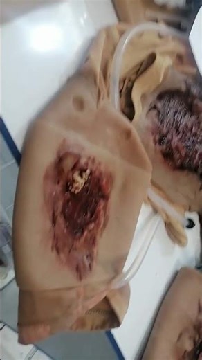 Realistic Silicone Human Flesh for Medical Training & Movie FX