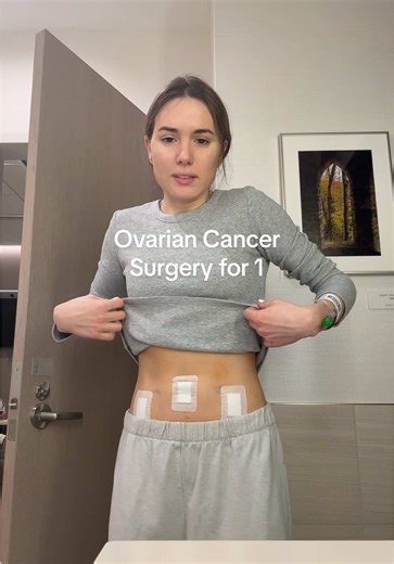 Ovarian Cancer Surgery Insights and Experiences