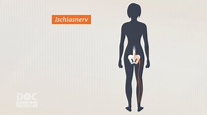 Doc Fischer: Ischias-Leiden - so können Sie Ischias-Schmerzen erkennen und behandeln