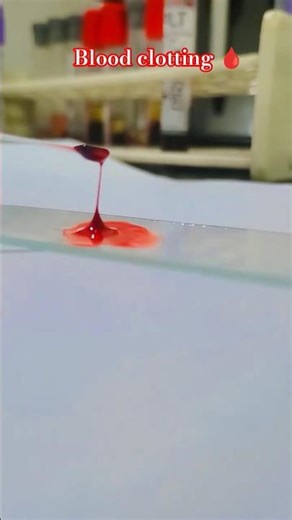 Blood clotting 🩸 #bloodtest #clotting #blood #labtechnician