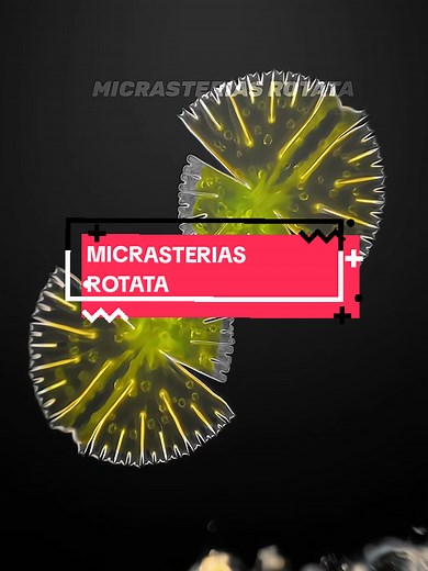 Menarik bet cuy, baca dikit ajh.. Makhluk Mikroskopis Ini Punya Bentuk Lebih Rumit Dari Teknologi Manusia Cuy Micrasterias rotata adalah salah satu organisme paling mind-blowing dalam dunia Biology dan Microbiology. Walaupun cuma organisme bersel satu, bentuknya simetris banget kayak ukiran alien atau snowflake hidup. Bahkan banyak ilmuwan nyebut genus Micrasterias sebagai salah satu mikroorganisme paling indah yang pernah dilihat di bawah mikroskop. Mereka hidup di air tawar seperti rawa, danau