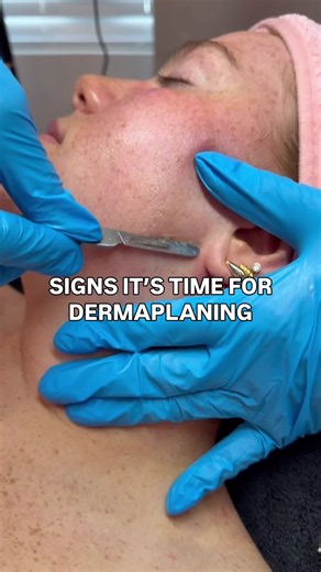 Dermaplane Facial Near Me — $50 Dermaplane Day Special (July 31)