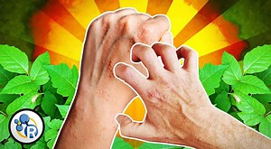 1.9K views · 20 reactions | The itchy, scratchy science behind poison ivy. | Reactions | Facebook