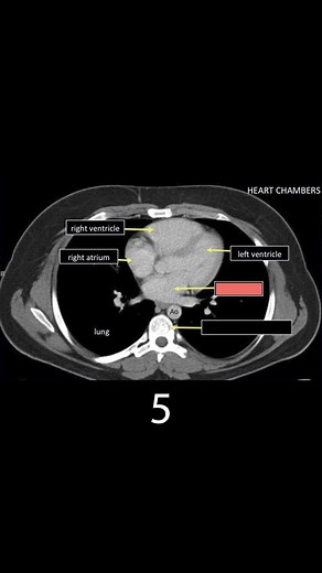 123K views · 1K reactions | Learn CT Anatomy (part 4) | CTisus: Cutting edge information on body CT (Computed tomography). | Facebook