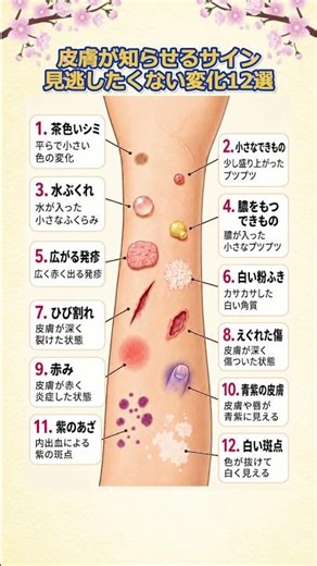 皮膚が知らせるサイン見逃したくない変化12選 #皮膚のサイン #肌の変化 #皮膚トラブル #発疹 #赤み#シミ #水ぶ