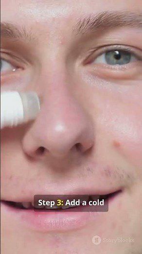 How to Stop a Nosebleed FAST (The Right Way) | First Aid Tips