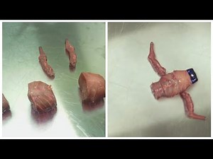 Scientists have built the first modular body: a living being that is not alive.