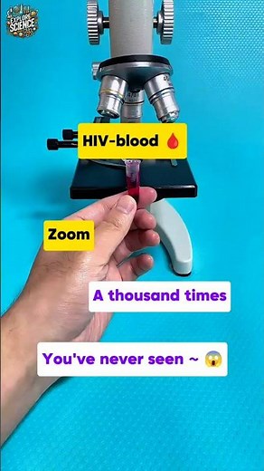 HIV Blood Under A Microscope #hiv