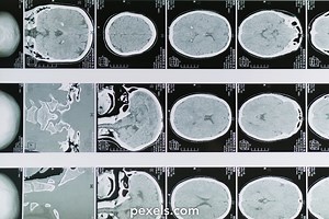 Brain Neuron Videos, Download The BEST Free 4k Stock Video Footage & Brain Neuron HD Video Clips