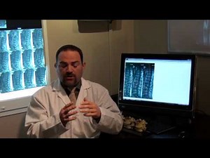 DRX9000 Spinal Decompression Therapy