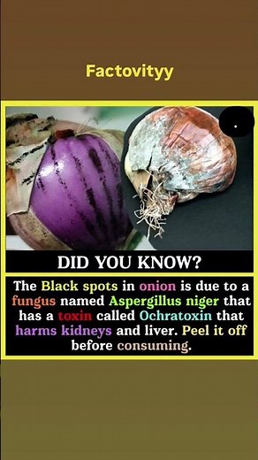 Black Spot in Onion 😱 Is It Safe to Eat?Truth Revealed#Onion #FoodSafety#foodfacts #shorts#subscribe