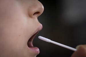 What are the symptoms of Coronavirus?