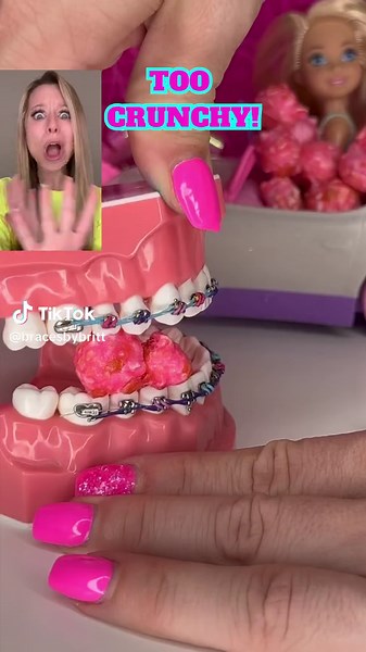Candy Braces Don't Mix: Barbie Movie Edition 🦷