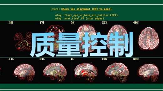 fMRI数据处理必要的质量控制-欢迎投稿问题数据