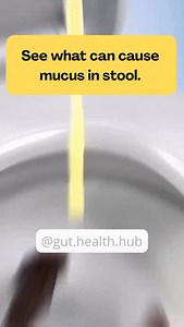 Mucus in the stool can be caused by several conditions. Some of the most common causes include: Intestinal infections: Bacteria, viruses, or parasites can irritate the intestine, leading to mucus production. Inflammatory bowel diseases: Conditions such as ulcerative colitis and Crohn’s disease can cause inflammation and increased mucus secretion. Irritable Bowel Syndrome (IBS): This condition may cause changes in bowel movements, including the presence of mucus. Food allergies or intolerances: S