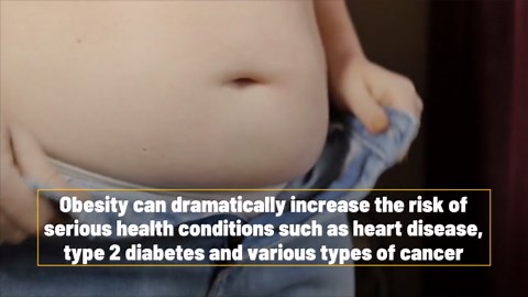 Over 1 Billion People Worldwide Live With Obesity