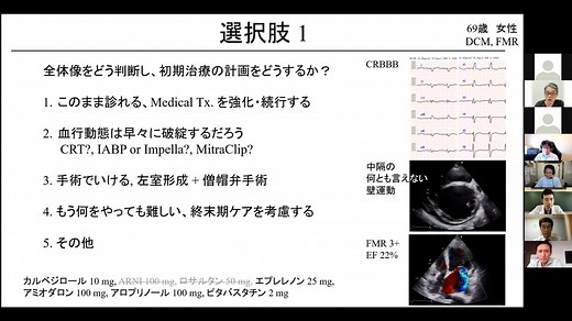 【見逃し配信】2021年8月21日 心不全とFMR 至適治療戦略を多面的に考える Part I