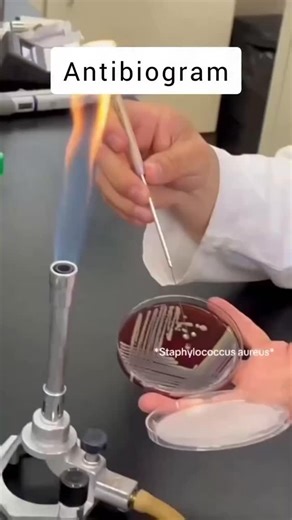 1.9K views · 1.1K reactions | Why do we run an antibiogram? Because guessing antibiotics is like playing roulette with germs. 匿  #microbiology #microbiologist #microbiologylab #explorepage #bacteriology #microbe #science #molecularbiology #kesfet #virology #pcr #cell #culture #media #molecular #lifescience #knowledge #know #fact #mikrobiyoloji #bacteria #bakteri #microbiologia #lab #laboratory #phd #phdstudent #fyp #viral #reel | Medical Microbiologist | Facebook
