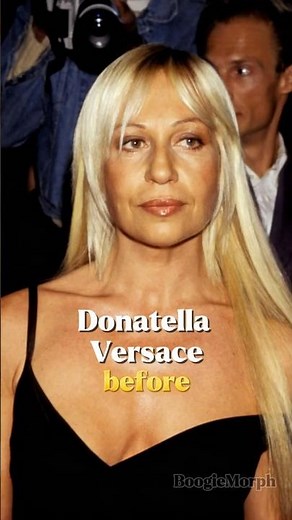 👉 Shocking Celebrity Transformations | When Plastic Surgery Goes Wrong Part 1 #plasticsurgery