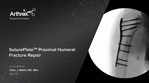SuturePlate™ Proximal Humeral Fracture Repair