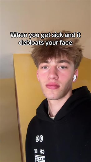 Understanding Facial Debloating When Sick