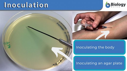 Inoculation Definition and Examples - Biology Online Dictionary