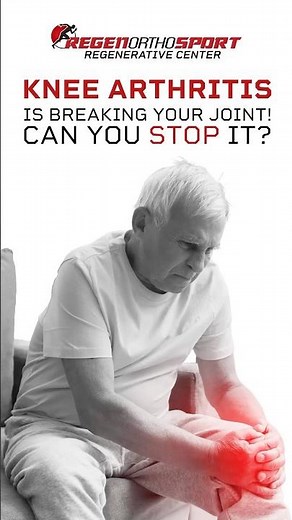 Struggling with Knee Pain? Non-Surgical Stem Cell & High Concentrated PRP Treatment Explained