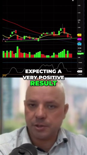 (ASX: ZIP) Expecting Positive Results, Trading Support Level