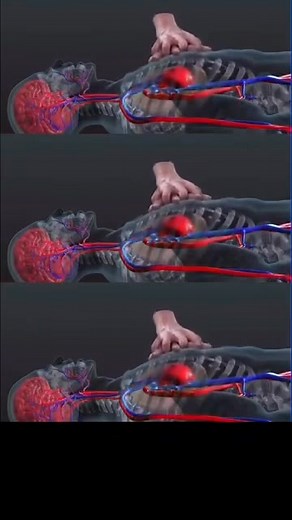 2.4K views · 23 reactions | CPR‼️ (cardiopulmonary resuscitation)...