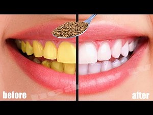 teeth whitening at home in 2 minutes how to naturally whiten your yellow teeth