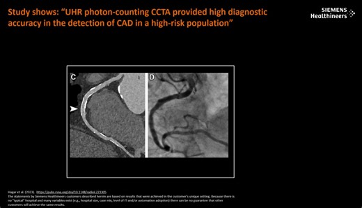 #infutureeveryctwillbephotoncountingct #rsna | Philipp Fischer