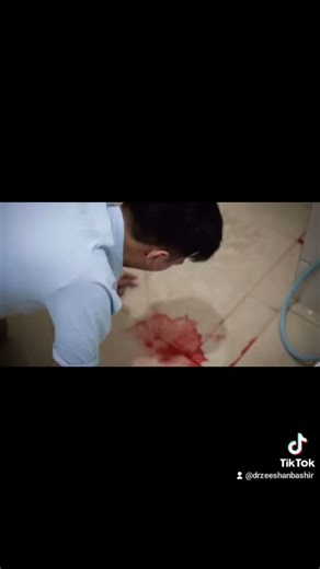 Blood Vomit. (Hematemesis)