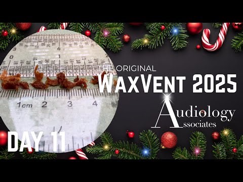 Narrow Ear Canal Packed with Sticky Ear Wax! - Waxvent Day 11