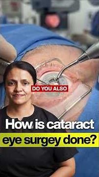 The Real Process of Cataract Eye Surgery — You Won't Believe How Simple It Is!