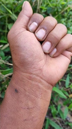 CUTE OR SCARY? #anyuniqueanimals #insects #wildlife