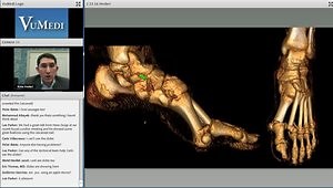 Biomechanics of the Foot and the Rationale for Midfoot Fracture Fixation