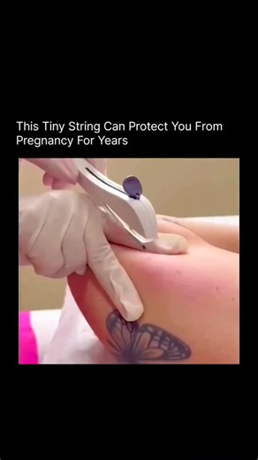 Medical | Health | Anatomy on Instagram: "This tiny string might look simple, but it's actually a powerful form of birth control called an IUD. Placed inside the uterus, it can protect against pregnancy for 3-10 years with more than 99% effectiveness. Once inserted, it works quietly in the background-no daily pills, no reminders, no interruptions. Some IUDs use copper to stop sperm, while others release hormones to prevent ovulation. It's safe, long-term, and completely reversible. Small device,