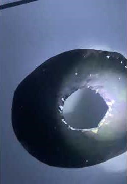 Ophthalmoscopy for beginners.